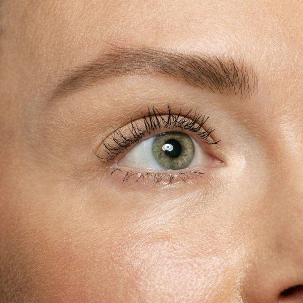 Manchas Primer plano extremo de la piel del rostro junto al ojo, para el tratamiento de Manchas de Instituto Médico Miramar